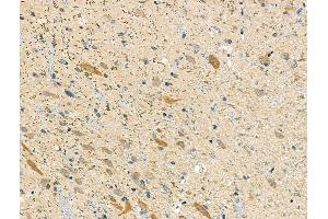 ABIN6258692 and ABIN6275486 at 1/100 staining Rat brain tissue by IHC-P.