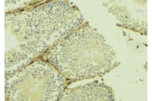 Immunohistochemistry (IHC) image for anti-UDP-Gal:betaGlcNAc beta 1,4- Galactosyltransferase, Polypeptide 3 (B4GALT3) (Internal Region) antibody (ABIN6258613)