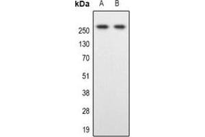 Western blot analysis of SPTBN1 expression in Hela (A), Colo205 (B) whole cell lysates. (SPTBN1 Antikörper)