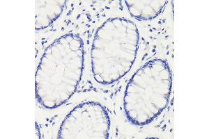 Immunohistochemistry of paraffin-embedded mouse stomach using GAPDH Mouse mAb (ABIN3020540, ABIN3020541, ABIN3020542 and ABIN1512934) at dilution of 1:100 (40x lens). (GAPDH Antikörper)