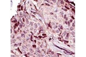 Immunohistochemistry (IHC) image for anti-Interleukin-1 Receptor-Associated Kinase 4 (IRAK4) (AA 5-36) antibody (ABIN3031498)