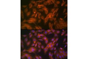 Immunofluorescence analysis of C6 cells using Calpain 1 Rabbit mAb (ABIN7266033) at dilution of 1:100 (40x lens). (CAPNL1 Antikörper)