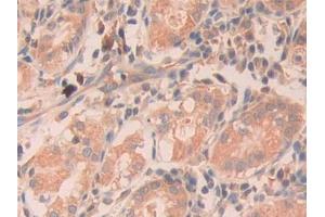 DAB staining on IHC-P; Samples: Human Stomach Tissue (RNASE11 Antikörper  (AA 18-199))