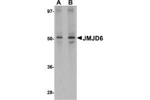 Western Blotting (WB) image for anti-Jumonji Domain Containing 6 (JMJD6) (N-Term) antibody (ABIN1031427) (JMJD6 Antikörper  (N-Term))