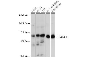 Western blot analysis of extracts of various cell lines, using TSEN54 Rabbit pAb (ABIN7271007) at 1:3000 dilution. (TSEN54 Antikörper  (AA 1-300))
