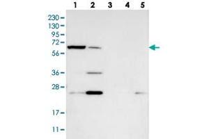 Western blot analysis of Lane 1: RT-4, Lane 2: U-251 MG, Lane 3: Human Plasma, Lane 4: Liver, Lane 5: Tonsil with KLHDC10 polyclonal antibody  at 1:250-1:500 dilution. (KLHDC10 Antikörper)