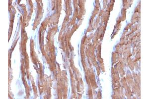Formalin-fixed, paraffin-embedded Rat Heart stained with Muscle Specific Actin Mouse Monoclonal Antibody (MSA/953). (ACTA1/ACTA2A/ACTG2 Antikörper)