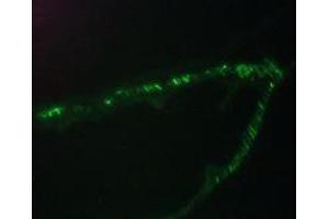 Immunofluorescence staining of a 7 days old zebrafish embryo (Desmin Antikörper)