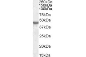 Western Blotting (WB) image for anti-Potassium Inwardly-Rectifying Channel, Subfamily J, Member 1 (KCNJ1) (Internal Region) antibody (ABIN2464210) (KCNJ1 Antikörper  (Internal Region))