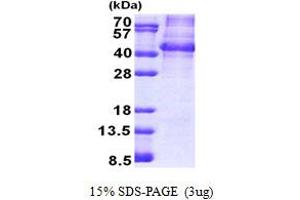 SDS-PAGE (SDS) image for Nanog Homeobox Pseudogene 8 (NANOGP8) (AA 1-305) protein (ABIN6387240)