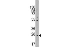 Western blot analysis of CD8B in K562 lysate (CD8B Antikörper  (AA 64-92))