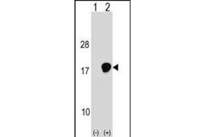 UBE2D3 Antikörper  (C-Term)