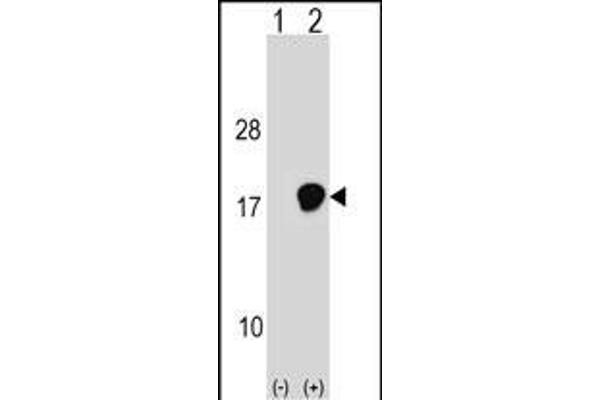 UBE2D3 Antikörper  (C-Term)