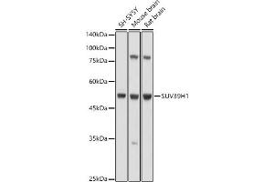 Western blot analysis of extracts of various cell lines, using SUV39H1 antibody (ABIN6128786, ABIN6148747, ABIN6148748 and ABIN6220187) at 1:1000 dilution. (SUV39H1 Antikörper  (AA 1-220))
