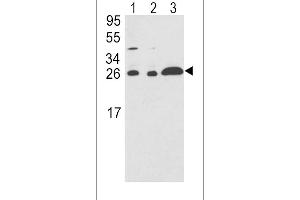 Western blot analysis of ARHGDIA Antibody (C-term) (ABIN389429 and ABIN2839511) in (lane 1),HL-60(lane 2),Ramos(lane 3) cell line lysates (35 μg/lane). (ARHGDIA Antikörper  (C-Term))