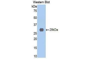 Western Blotting (WB) image for anti-Cathepsin D (CTSD) (AA 169-408) antibody (ABIN1858545)
