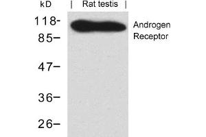Image no. 1 for anti-Androgen Receptor (AR) (AA 648-652) antibody (ABIN401550) (Androgen Receptor Antikörper  (AA 648-652))