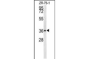 Western blot analysis in ZR-75-1 cell line lysates (35ug/lane). (Nitrilase 1 Antikörper  (C-Term))