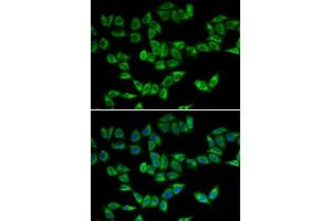 Immunofluorescence analysis of U2OS cells using PRDX5 antibody. (Peroxiredoxin 5 Antikörper  (AA 53-214))