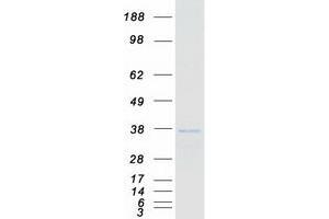 Western Blotting (WB) image for General Transcription Factor IIB (GTF2B) protein (Myc-DYKDDDDK Tag) (ABIN2722309)
