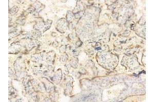 ABIN6261114 and ABIN6266520 at 1/100 staining human normal placenta tissue by IHC-P. (Cullin 1 Antikörper  (C-Term))