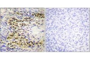 Immunohistochemistry analysis of paraffin-embedded human ovary, using Akt (Phospho-Thr72) Antibody.