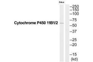 Western blot analysis of extracts from COLO205 cells, using Cytochrome P450 11B1/2 antibody.
