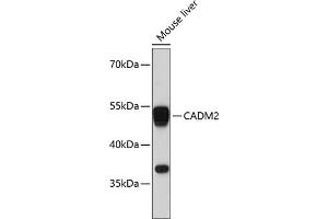 Western blot analysis of extracts of mouse liver, using C antibody (ABIN6129649, ABIN6137839, ABIN6137840 and ABIN6215420) at 1:3000 dilution. (CADM2 Antikörper  (AA 220-335))
