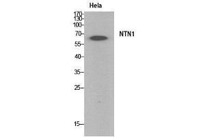 Western Blot (WB) analysis of HeLa cells using Netrin-1 Polyclonal Antibody. (Netrin 1 Antikörper  (Internal Region))