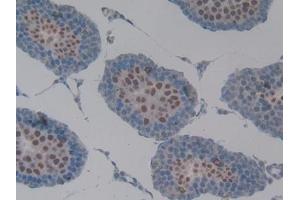 Detection of MUC1 in Rat Testis Tissue using Polyclonal Antibody to Mucin 1 (MUC1) (MUC1 Antikörper  (AA 404-655))