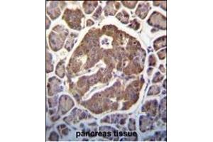 P3K13 (LZK) Antibody (C-term)  (ABIN652423 and ABIN2842093) immunohistochemistry analysis in forlin fixed and paraffin embedded hun pancreas tissue followed by peroxidase conjugation of the secondary antibody and DAB staining. (MAP3K13 Antikörper  (C-Term))