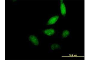 Immunofluorescence of purified MaxPab antibody to ELF2 on HeLa cell. (ELF2 Antikörper  (AA 1-581))