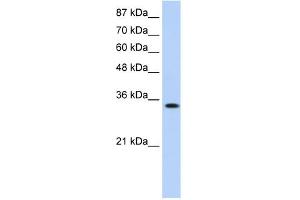 WB Suggested Anti-MBNL1 Antibody Titration:  0. (MBNL1 Antikörper  (Middle Region))