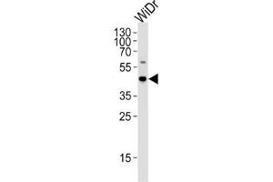 Western Blotting (WB) image for anti-Chromosome 9 Open Reading Frame 72 (C9ORF72) antibody (ABIN2997029) (C9ORF72 Antikörper)