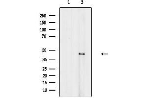 anti-Kruppel-Like Factor 12 (KLF12) (Internal Region) antibody