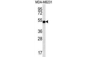 Western Blotting (WB) image for anti-Signal Transducing Adaptor Family Member 2 (STAP2) antibody (ABIN2996919) (STAP2 Antikörper)