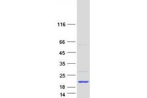 Western Blotting (WB) image for Endosulfine alpha (ENSA) (Transcript Variant 8) protein (Myc-DYKDDDDK Tag) (ABIN2714623)