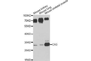 Western blot analysis of extracts of various cell lines, using CA3 antibody. (CA3 Antikörper)