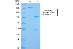 SDS-PAGE Analysis Purified Desmin Rabbit Recombinant Monoclonal Antibody (DES/2960R). (Rekombinanter Desmin Antikörper)