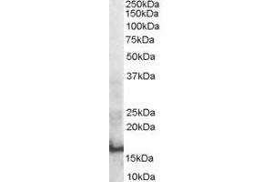 Western Blotting (WB) image for anti-SH2 Domain Containing 1A (SH2D1A) (AA 73-82) antibody (ABIN297645)