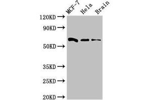 Western Blot Positive WB detected in: MCF-7 whole cell lysate, Hela whole cell lysate, Mouse brain tissue All lanes: SGO1 antibody at 3 μg/mL Secondary Goat polyclonal to rabbit IgG at 1/50000 dilution Predicted band size: 65, 36, 34, 32, 30, 61, 25 kDa Observed band size: 65 kDa (Shugoshin Antikörper  (AA 260-439))