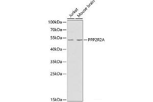 Western blot analysis of extracts of various cell lines using PPP2R2A Polyclonal Antibody at dilution of 1:1000. (PPP2R2A Antikörper)