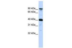 Image no. 1 for anti-Cysteinyl-tRNA Synthetase (CARS) (AA 756-805) antibody (ABIN6740660) (CARS Antikörper  (AA 756-805))