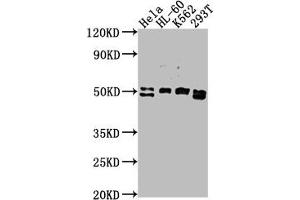 Western Blot Positive WB detected in: HeLa whole cell lysate, HL-60 whole cell lysate, K562 whole cell lysate, 293T whole cell lysate All lanes: DDX47 antibody at 1:2000 Secondary Goat polyclonal to rabbit IgG at 1/50000 dilution Predicted band size: 51, 46 kDa Observed band size: 51 kDa (DDX47 Antikörper  (AA 225-460))