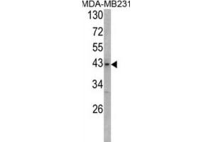 anti-USP12,USP46 antibody