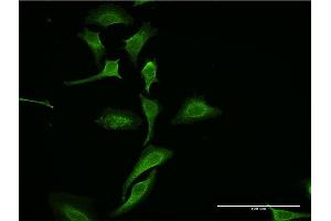 Immunofluorescence of monoclonal antibody to DKK1 on HeLa cell. (DKK1 Antikörper  (AA 171-266))
