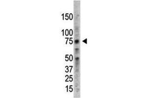PRMT5 antibody used in western blot to detect PRMT5 in HL-60 cell lysate