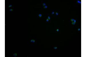 Immunofluorescence staining of PC3 cells with ABIN7167626 at 1:100, counter-stained with DAPI.