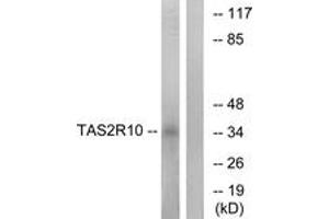 Western blot analysis of extracts from LOVO cells, using TAS2R10 Antibody.