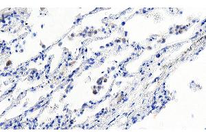 Immunohistochemistry (IHC) image for anti-Ionized Calcium-binding Adapter Molecule 1 (IBA1) (C-Term) antibody (ABIN184738)